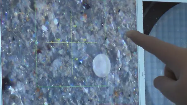 Forscher jetzt sicher: Mikroplastik macht Krebs!