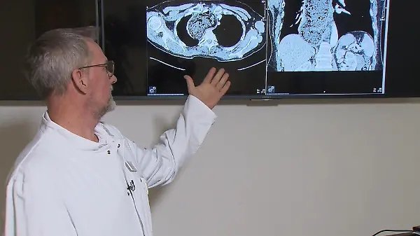 Frau hat literweise Essen in der Speiseröhre